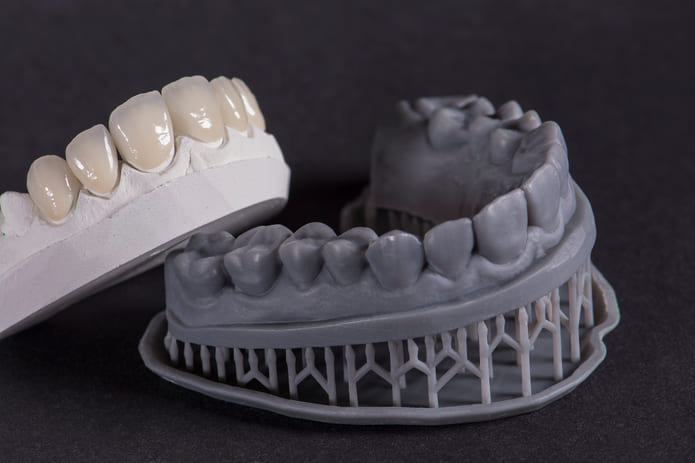 Imagen de protesis dental impresa en 3D